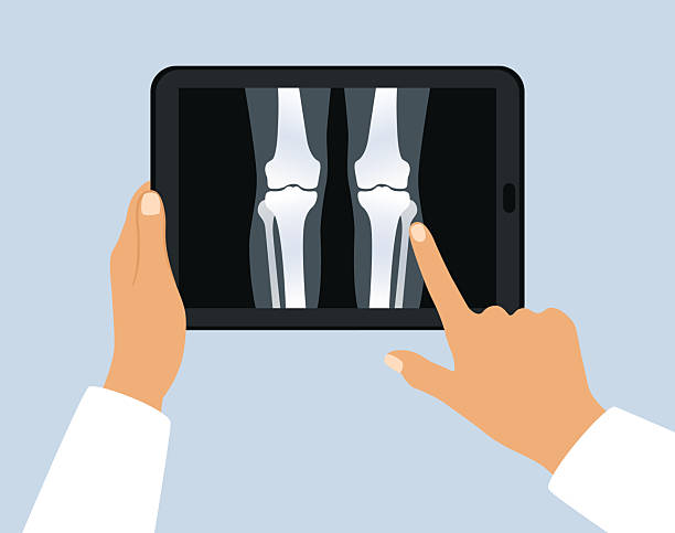 Joint and Bone Health